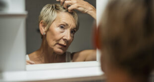 Understanding Female Pattern Hair Loss