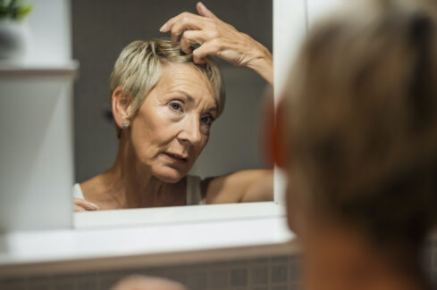 Understanding Female Pattern Hair Loss