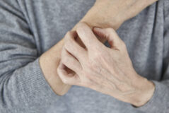 Why Dry Skin Gets Worse as We Age